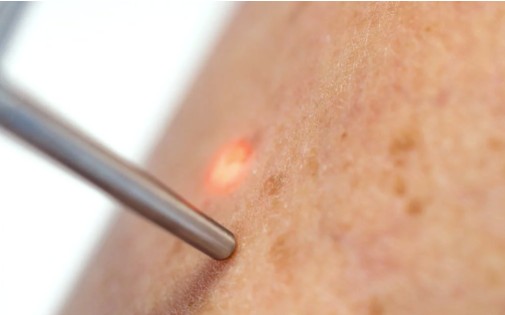 capture d’écran 2026 01 15 161531