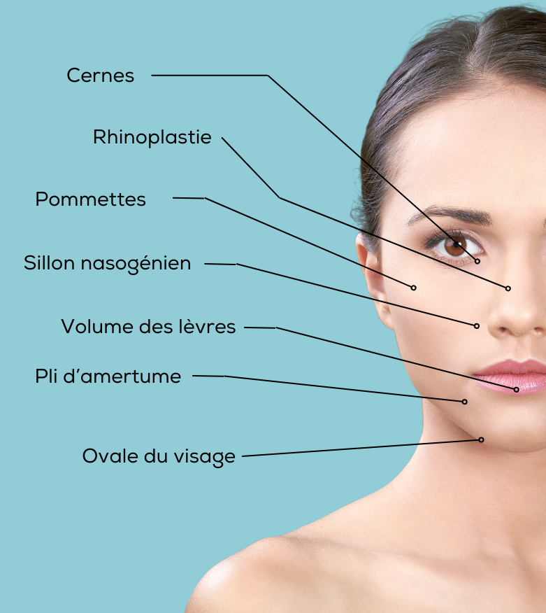 Injection d’acide hyaluronique haut de france