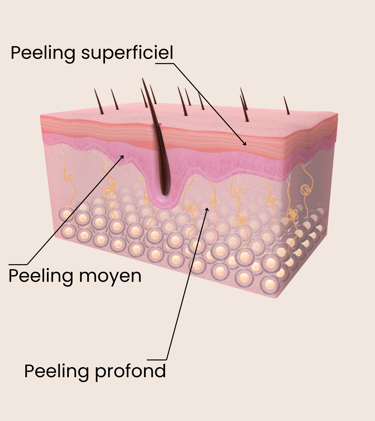 faire un peeling professionnel à valenciennes