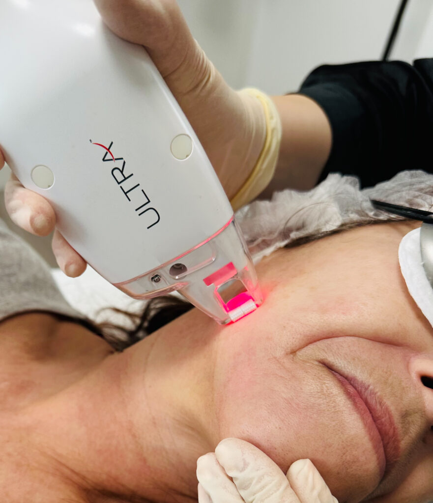 Laser MD Ultra à Valenciennes