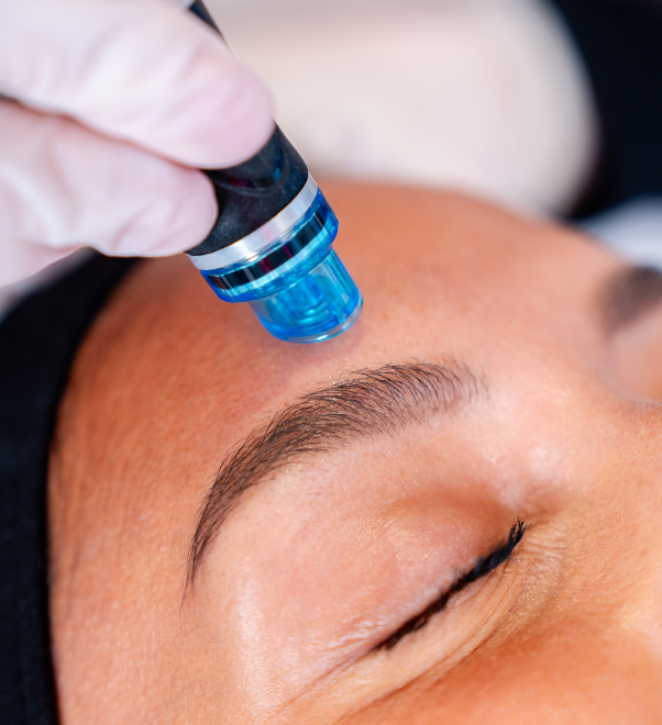 technique medicale hydrafacial