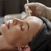 peeling valenciennes